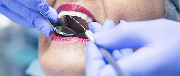 Best Dental Abscess Treatment in Dora, AL